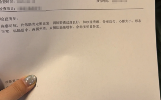 新余市鸡西入职体检报告